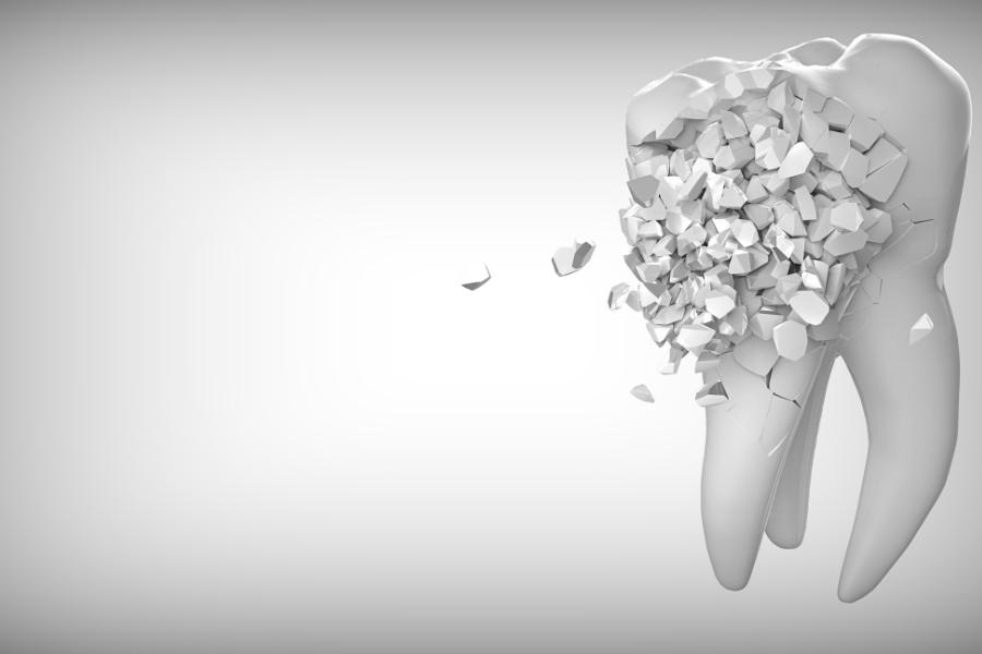 La forma de recuperar un diente tras un golpe, el reimplante dental