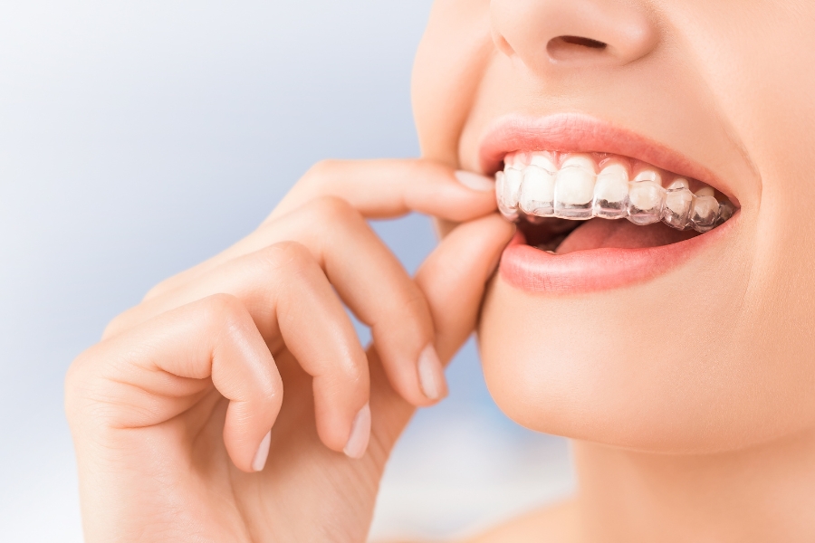 Conocer las ventajas de la ortodoncia invisible