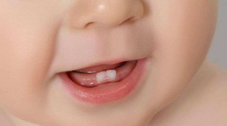 dentista bebés